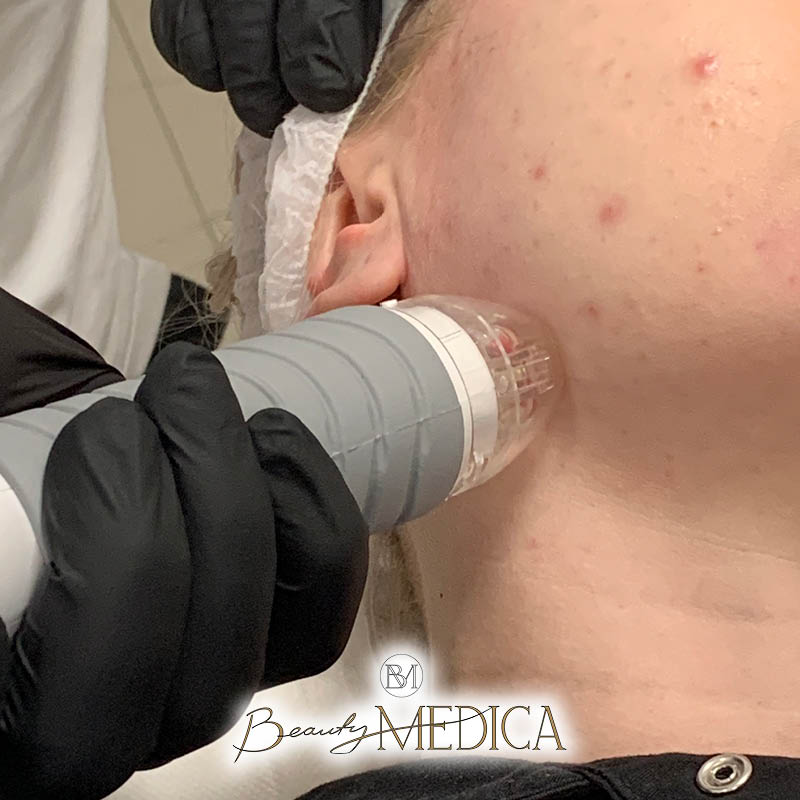 Beauty Medica Zabieg 31